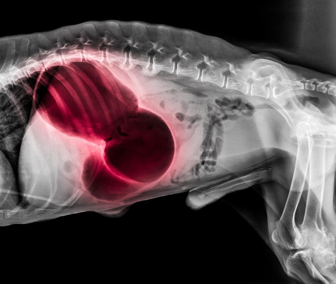 Torze žaludku – lze jí předejít?